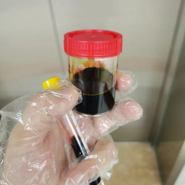 急性肝衰竭！兩兄弟誤吃這種菌 專家提醒